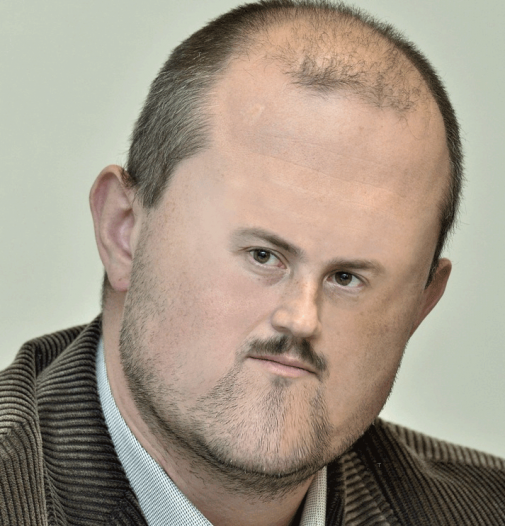 kotleba ma prilis velky tvar!!